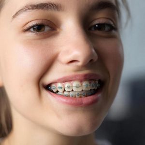 Улыбка без границ: Круглосуточная забота о ровных зубах для всей семьи