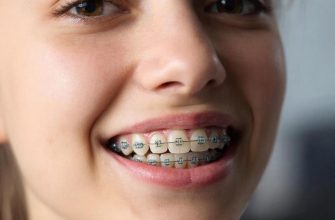 Улыбка без границ: Круглосуточная забота о ровных зубах для всей семьи